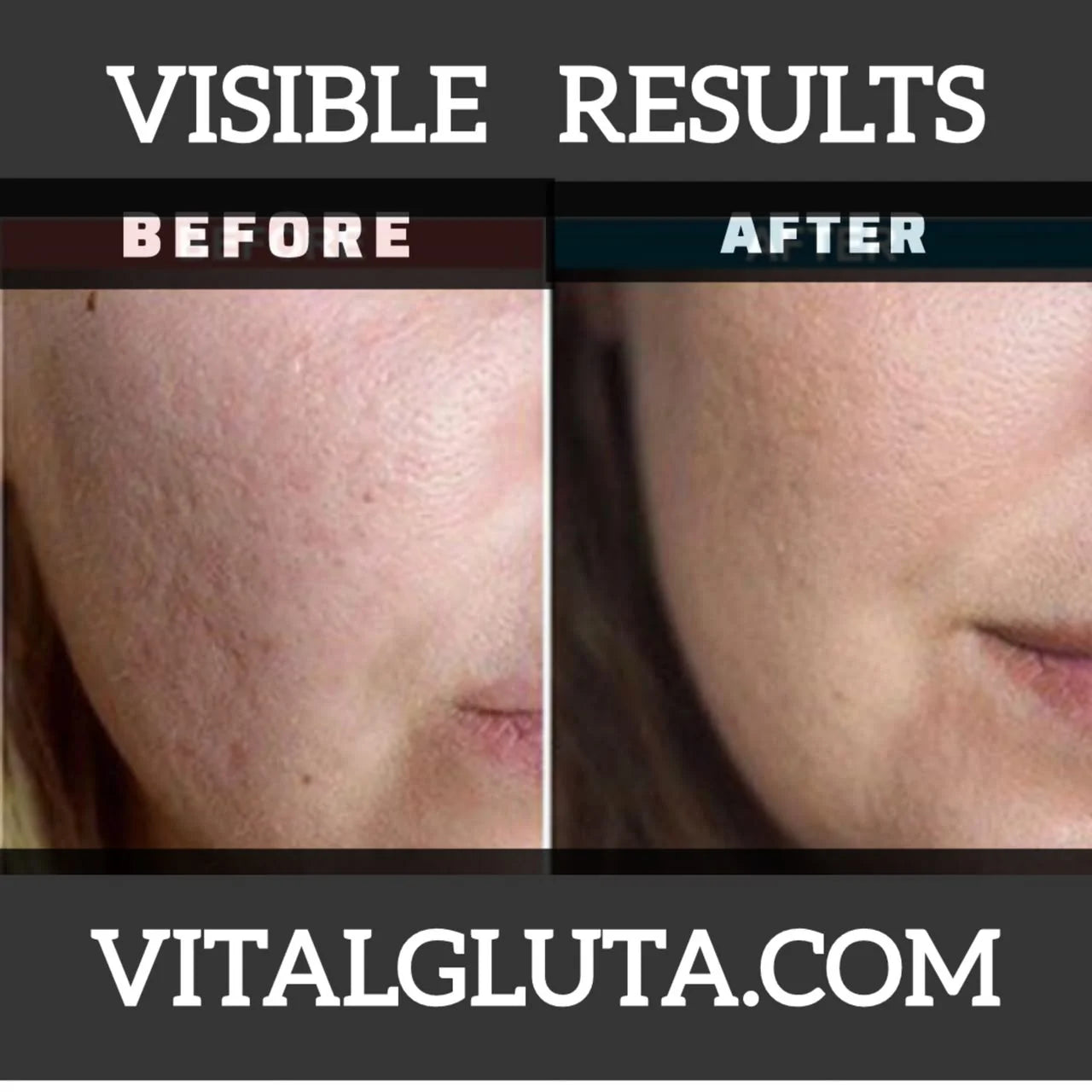 Before and after comparison of facial skin texture on the cheek, with the text 'VISIBLE RESULTS' at the top and 'VITALGLUTA.COM' at the bottom.