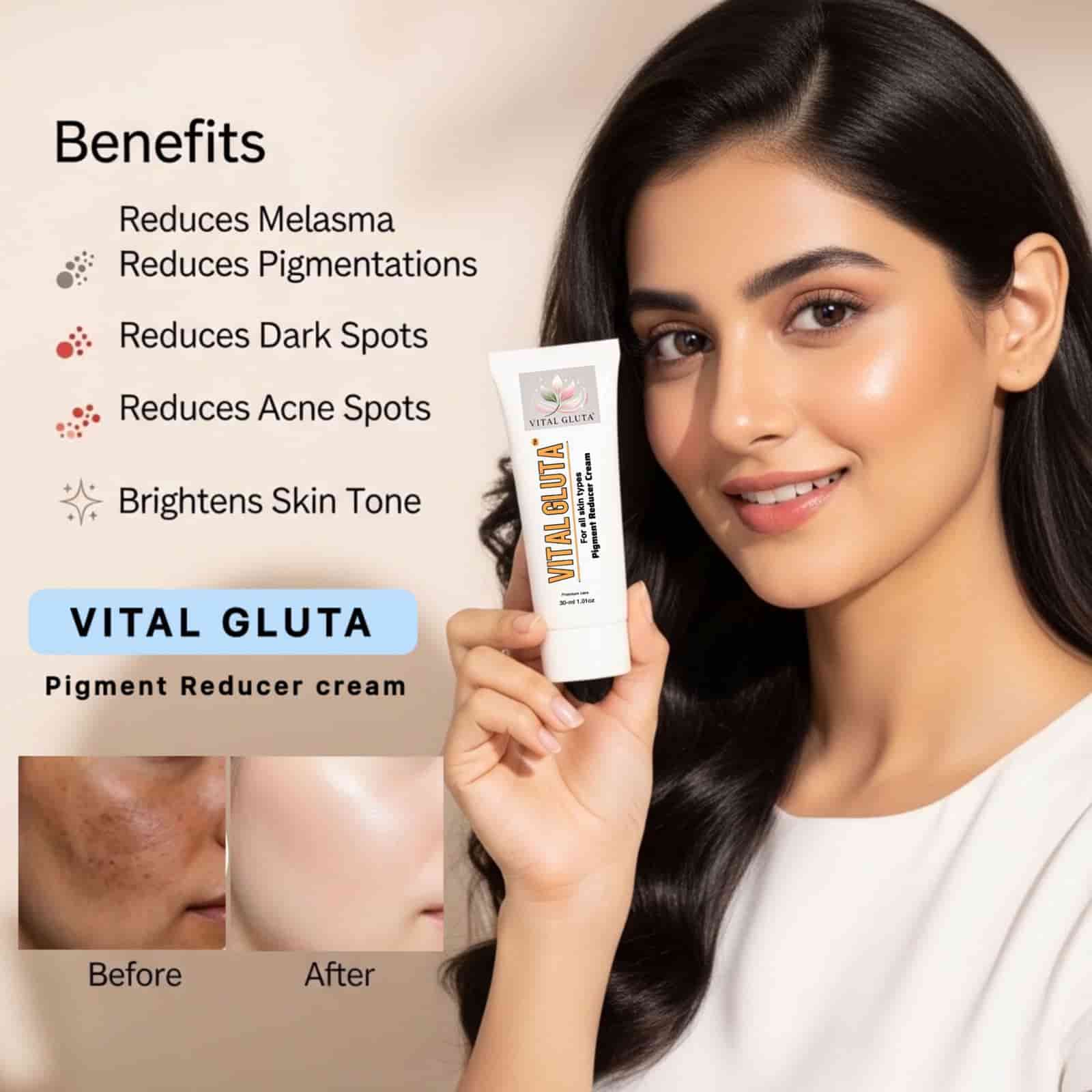 1 VitalGluta Pigment Reducer Anti - Pigmentation Cream 30g - Vital Gluta